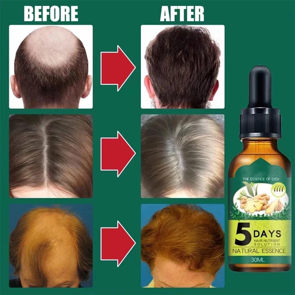 Sérum Cheveux